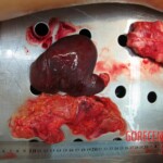 Autopsy of Chinese woman