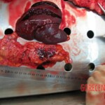 Autopsy of Chinese woman