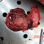 Autopsy of Chinese woman