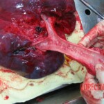 Autopsy of Chinese woman