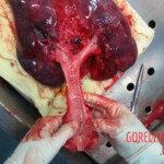 Autopsy of Chinese woman