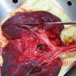 Autopsy of Chinese woman