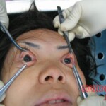 Autopsy of Chinese woman