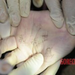 Drowned woman in morgue