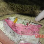 Drowned woman in morgue