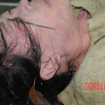 Drowned woman in morgue