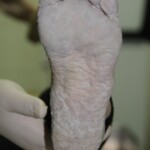 Drowned woman in morgue