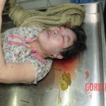 Drowned woman in morgue