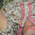 Drowned woman in morgue