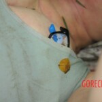 Drowned woman in morgue