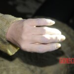 Drowned woman in morgue