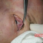 Drowned woman in morgue