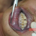 Drowned woman in morgue