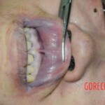 Drowned woman in morgue