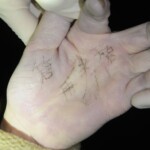 Drowned woman in morgue