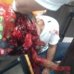 Destroyed head after machete attack