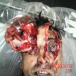 Destroyed head after machete attack