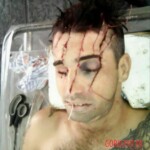Destroyed head after machete attack