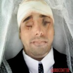 Destroyed head after machete attack