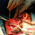 Blown off face surgery