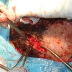 Blown off face surgery