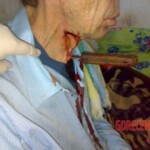 Knife stuck in throat