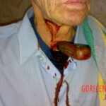 Knife stuck in throat