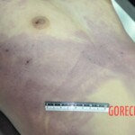 Dead skinny tattooed girl