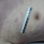 Dead skinny tattooed girl