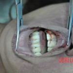 Dead skinny tattooed girl