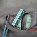 Dead skinny tattooed girl