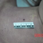 Dead skinny tattooed girl