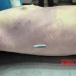 Dead skinny tattooed girl