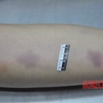 Dead skinny tattooed girl