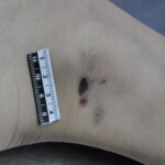 Dead skinny tattooed girl