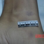 Dead skinny tattooed girl