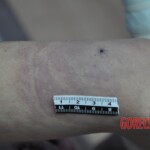 Dead skinny tattooed girl