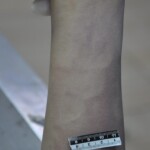 Dead skinny tattooed girl