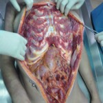 Dead skinny tattooed girl