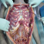 Dead skinny tattooed girl