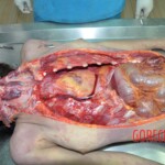 Dead skinny tattooed girl