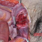 Dead skinny tattooed girl