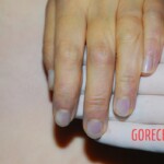 Examination of dead woman