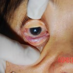 Examination of dead woman