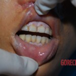 Examination of dead woman