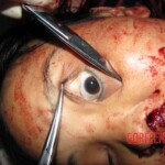 Slashed woman