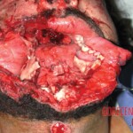 Facial plastic surgery