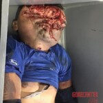 Head crushed by hydraulic press