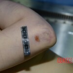 Raped girl in morgue