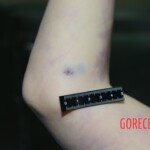 Raped girl in morgue